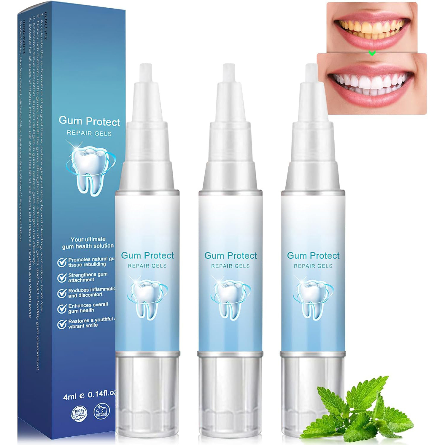 main1-29 Gum Protect Teeth Whitening Pen - 4 Styles (A/B/C/D) - 图片 1